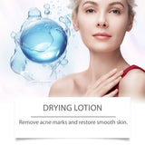 Sérum Visage à l’Acide Salicylique Anti-Acné
